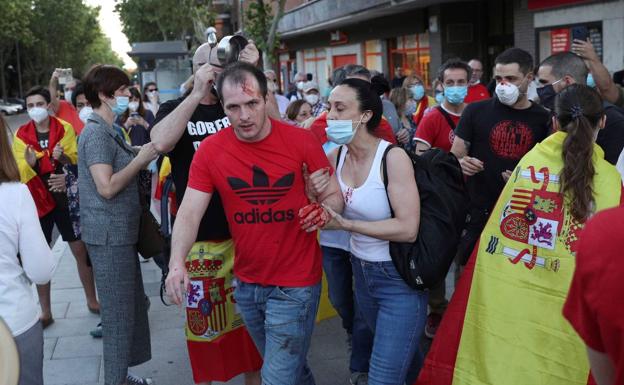 Joven herido durante las protestas contra el Gobierno en el barrio madrileño de Moratalaz.