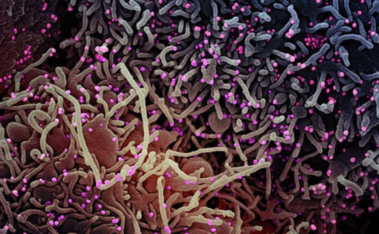 Coronavirus (en rosa) en el interior de una célula humana. 