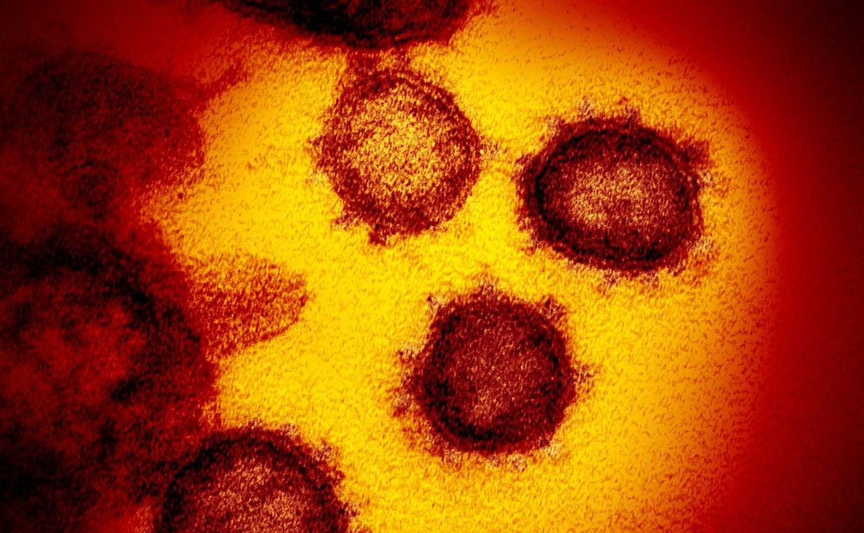 Imagen del coronavirus SARS-CoV-2, causante del COVID-19, tomada con microscopio electrónico