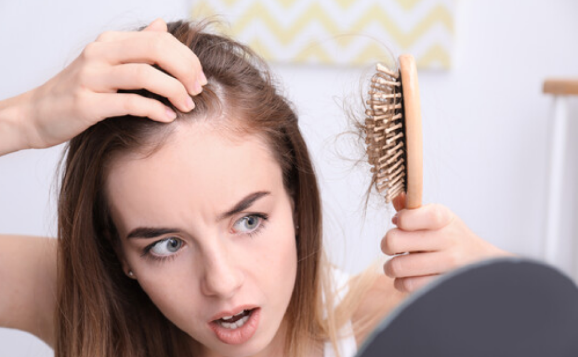 Una mujer con alopecia. 