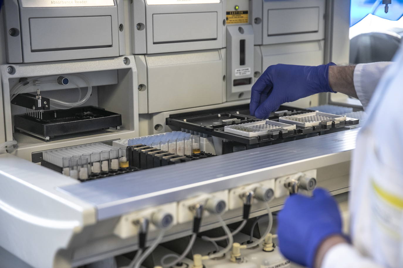 Análisis de pruebas de COVID en los laboratorios del San Pedro. 