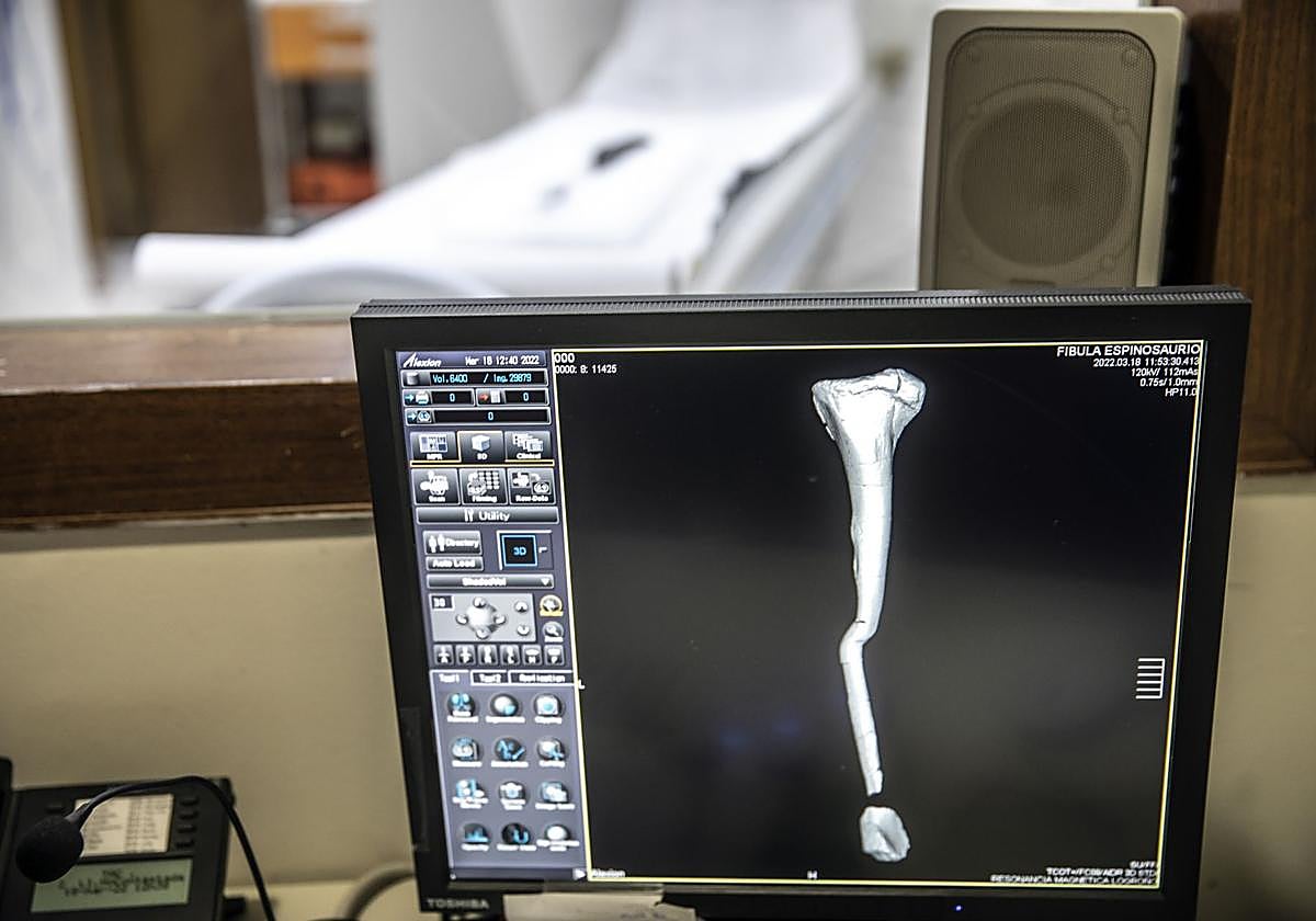 Muere un hombre tras ser absorbido por una máquina de resonancia magnética por llevar puesta una cadena metálica