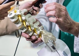 Modelo de un dispositivo empleado en la Unidad del Dolor.