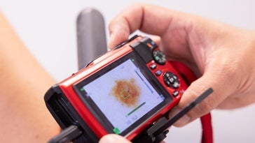 Un profesional sanitario de Atención Primaria revisa la piel de un paciente con las herramientas de teledermatología, en una imagen de archivo.