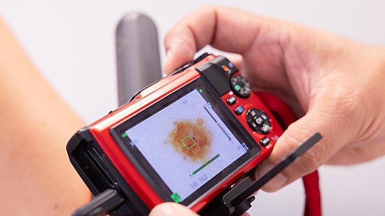 Un profesional sanitario de Atención Primaria revisa la piel de un paciente con las herramientas de teledermatología, en una imagen de archivo.
