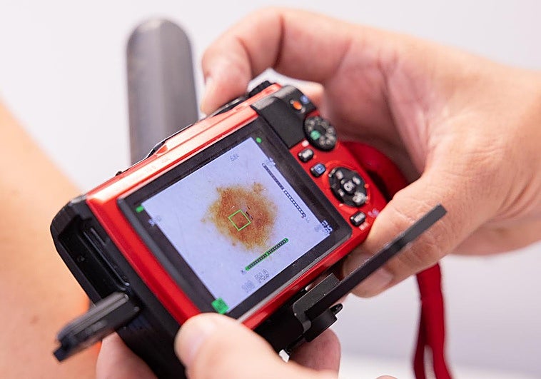 Un profesional sanitario de Atención Primaria revisa la piel de un paciente con las herramientas de teledermatología, en una imagen de archivo.