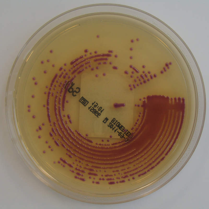 E.coli