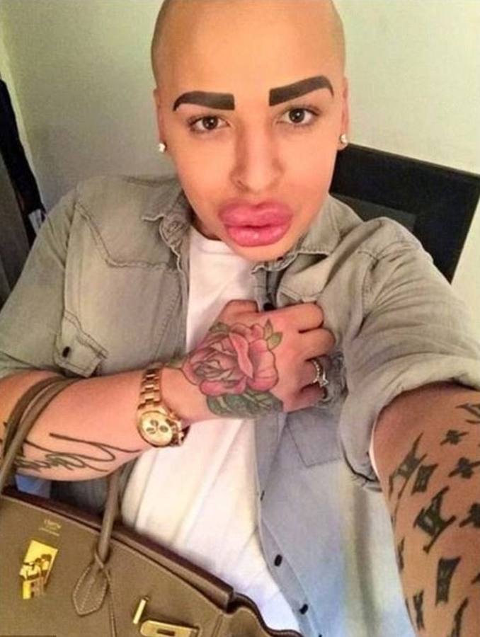 Se gasta 121.000 euros para parecerse a Kim Kardashian