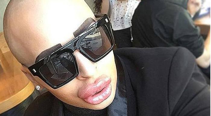 Se gasta 121.000 euros para parecerse a Kim Kardashian