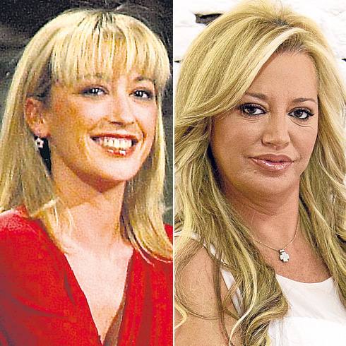 El antes y el después de Belén Esteban. 