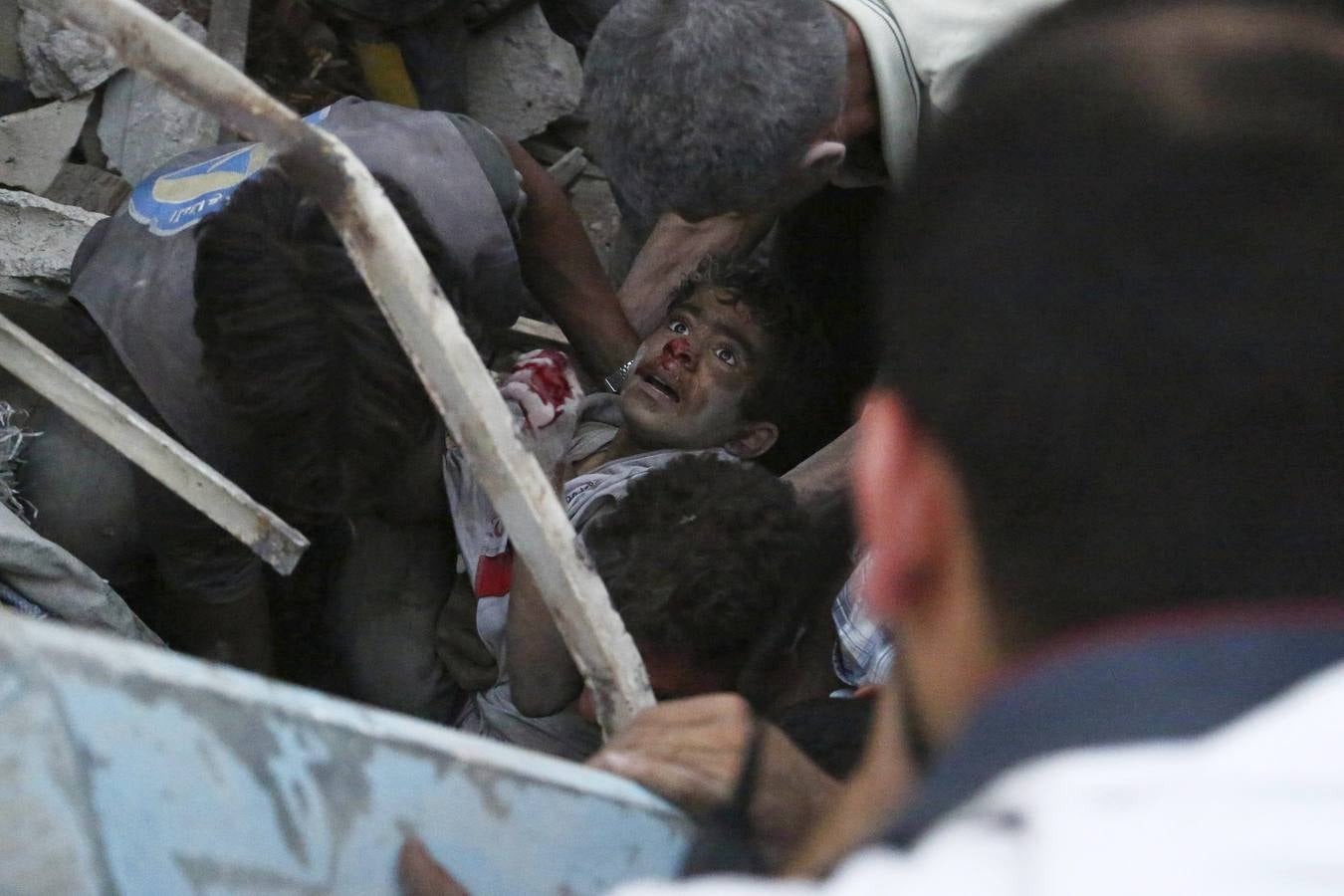 Fotografía de la serie ganadora del primer premio en Historias de la categoría noticias de actualidad, del fotógrafo. La imagen muestra a un grupo de hombres sacando a un niño herido de entre los escombros que han dejado los bombardeos efectuados sobre la ciudad de Douma, en la zona rebelde de Siria, el 15 de junio de 2015.