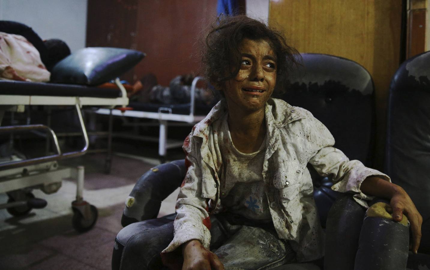 Segundo premio de la categoría de temas de Actualidad de la 59 edición del World Press Photo, tomada por el fotógrafo Abd Doumany. La fotografía muestra a una niña siria llorando en un hospital de Douma, al este de Damasco (Siria) el 12 de agosto de 2015.