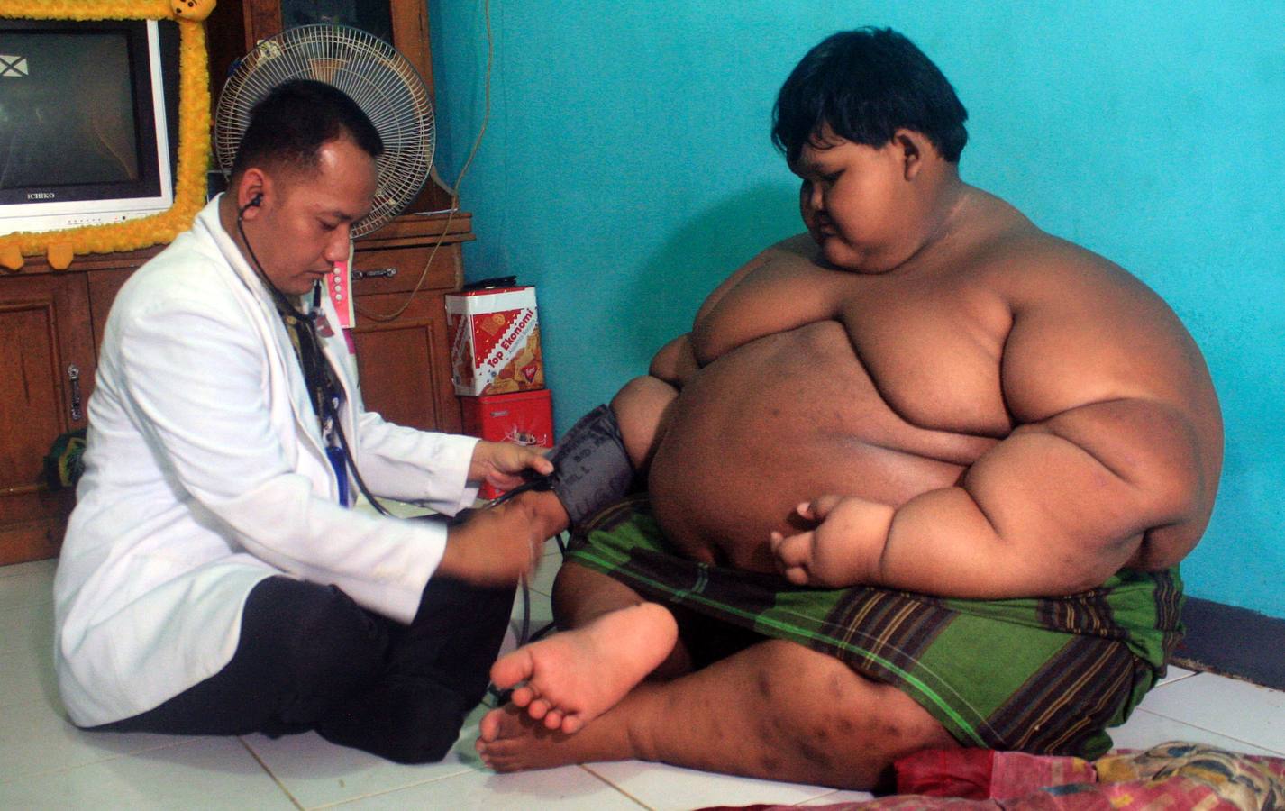 El niño más gordo del mundo. Arya Permana, de 10 años y de Karawang (Java oriental), considerado uno de los niños más gordos del mundo, con 192 kilos. AFP PHOTO / MAHENDRA