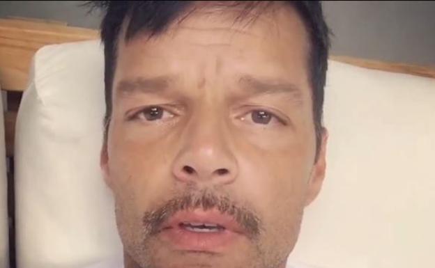 Ricky Martin preocupa a sus seguidores por su aspecto 