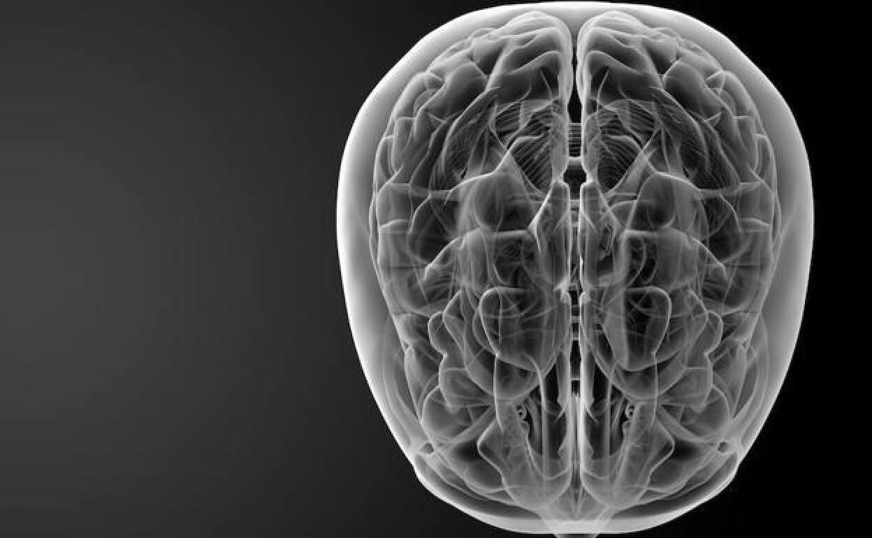 Cerebro humano visto a través de rayos x.