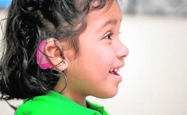 Los niños implantados antes de los tres años son capaces de aprender y dominar el lenguaje oral
