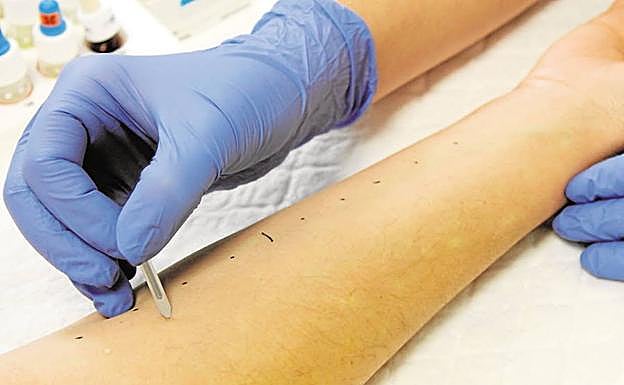 Prueba cutánea para detectar alergias.