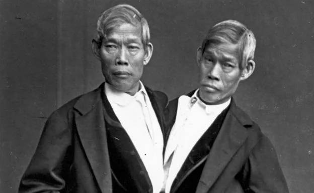 Los siameses Chang y Eng llegaron al mundo en 1811 y siguieron juntos hasta el final. 
