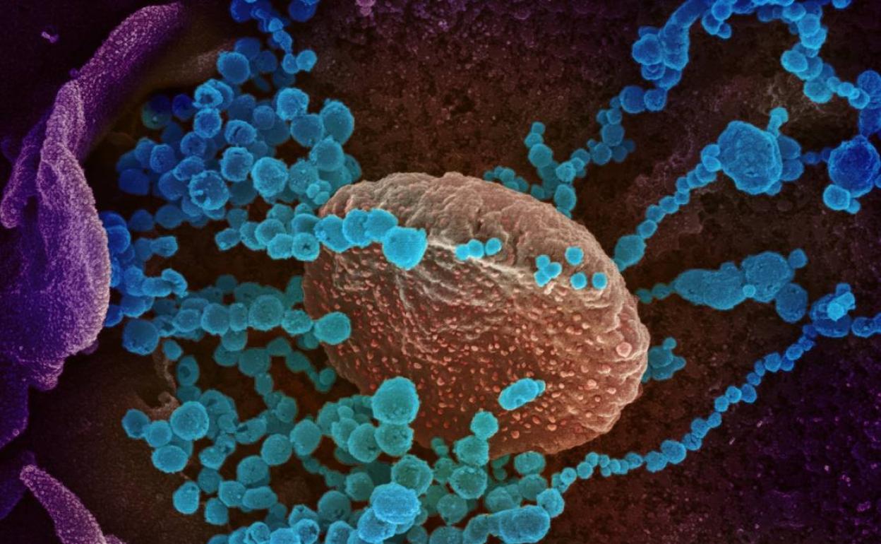 El virus (en azul) que causa el brote de Coronavirus (Covid-19), en una imagen microscópica.