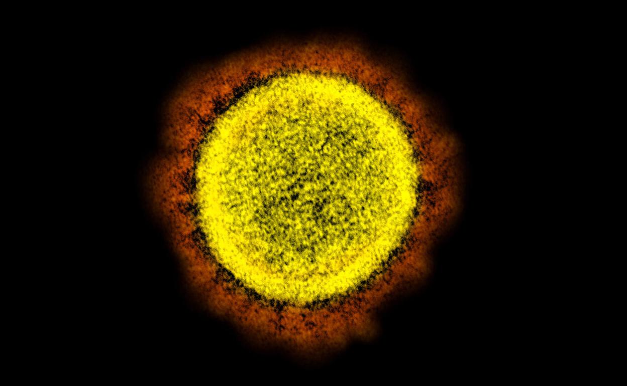 Imagen del coronavirus SARS-CoV-2, causante del COVID-19, tomada con microscopio electrónico. 