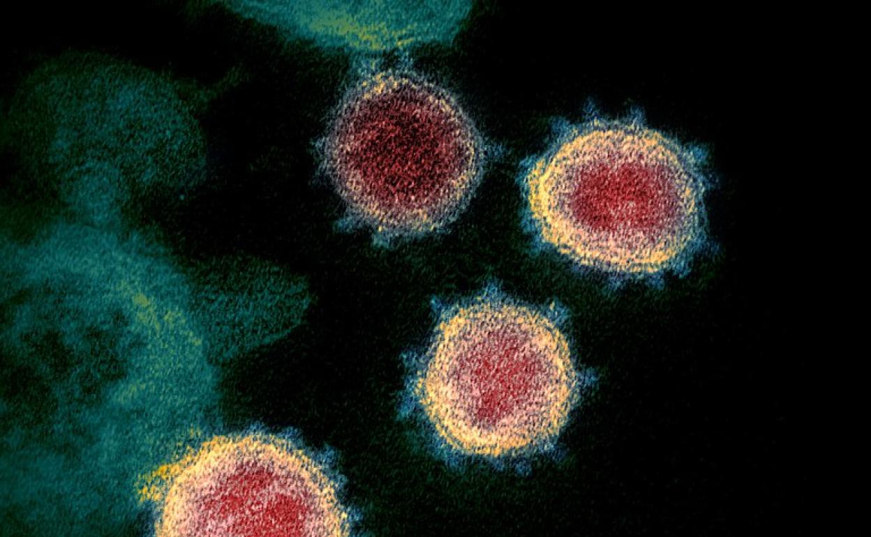 El virus SARS-CoV-2 que causa la enfermedad del coronavirus, bajo el microscopio.