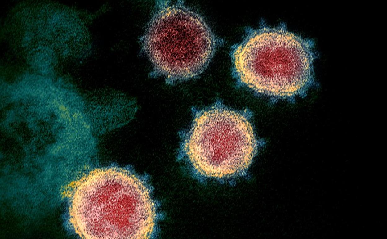 El virus SARS-CoV-2 que causa la enfermedad del coronavirus.