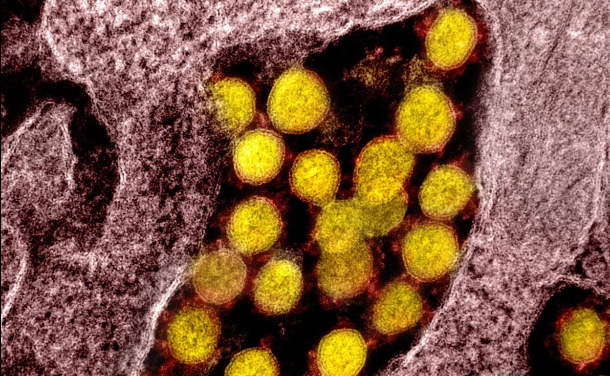 Imagen del coronavirus SARS-CoV-2, causante del COVID-19, tomada con microscopio electrónico.