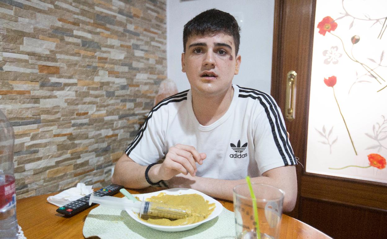 El joven Adrián, con el rostro destrozado por la agresión y la comida triturada a causa de sus lesiones, en su casa de Valencia. 