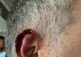 La oreja, ya reconstruida tras la agresión.