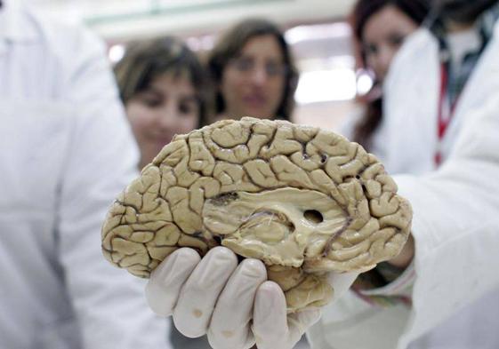 Un grupo de investigadores con una reproducción de un cerebro