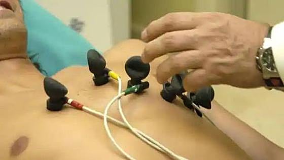 Investigadores identifican un actor clave en el proceso de formación del corazón