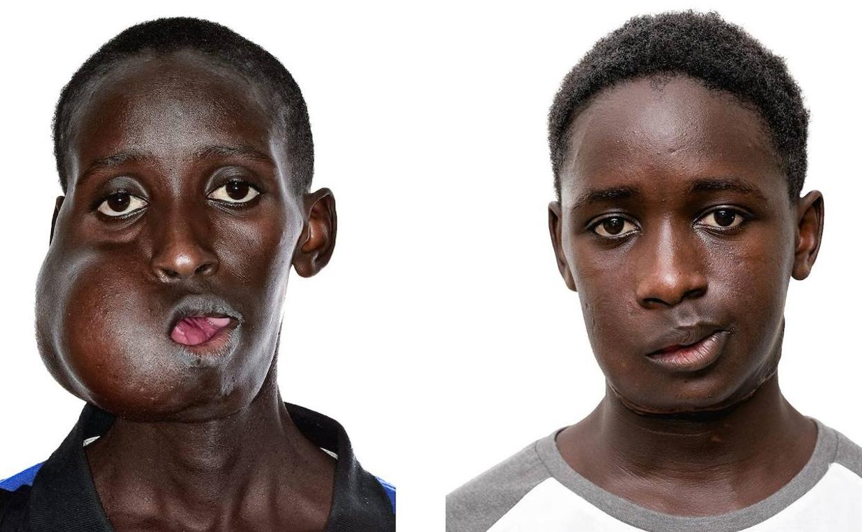 Mamadou antes y después.