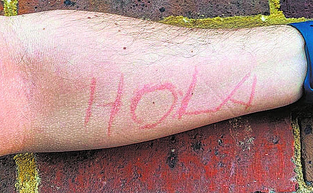 Imagen del brazo de Pablo segundos después de 'dibujar' un 'HOLA'.