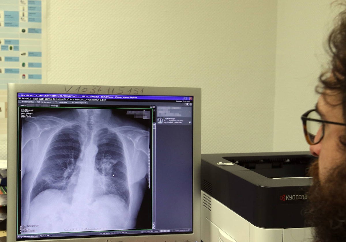 Un facultativo observa los pulmones de un paciente.