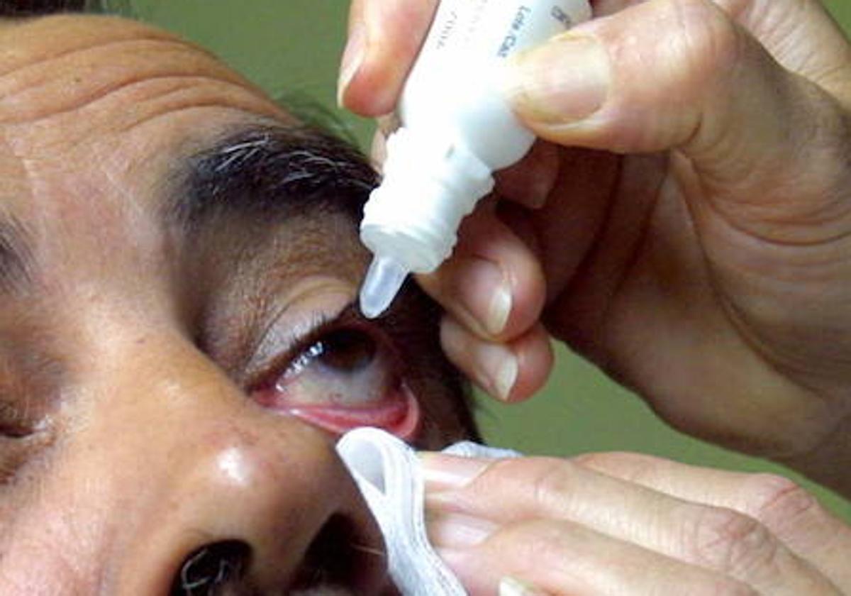 Imagen de archivo de un hombre aplicándose colirio en un ojo.