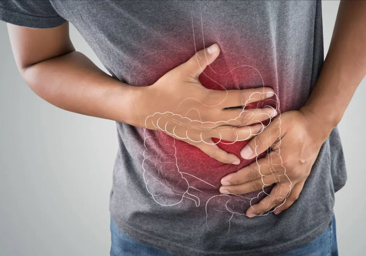 Colon irritable: síntomas, causas y tratamiento