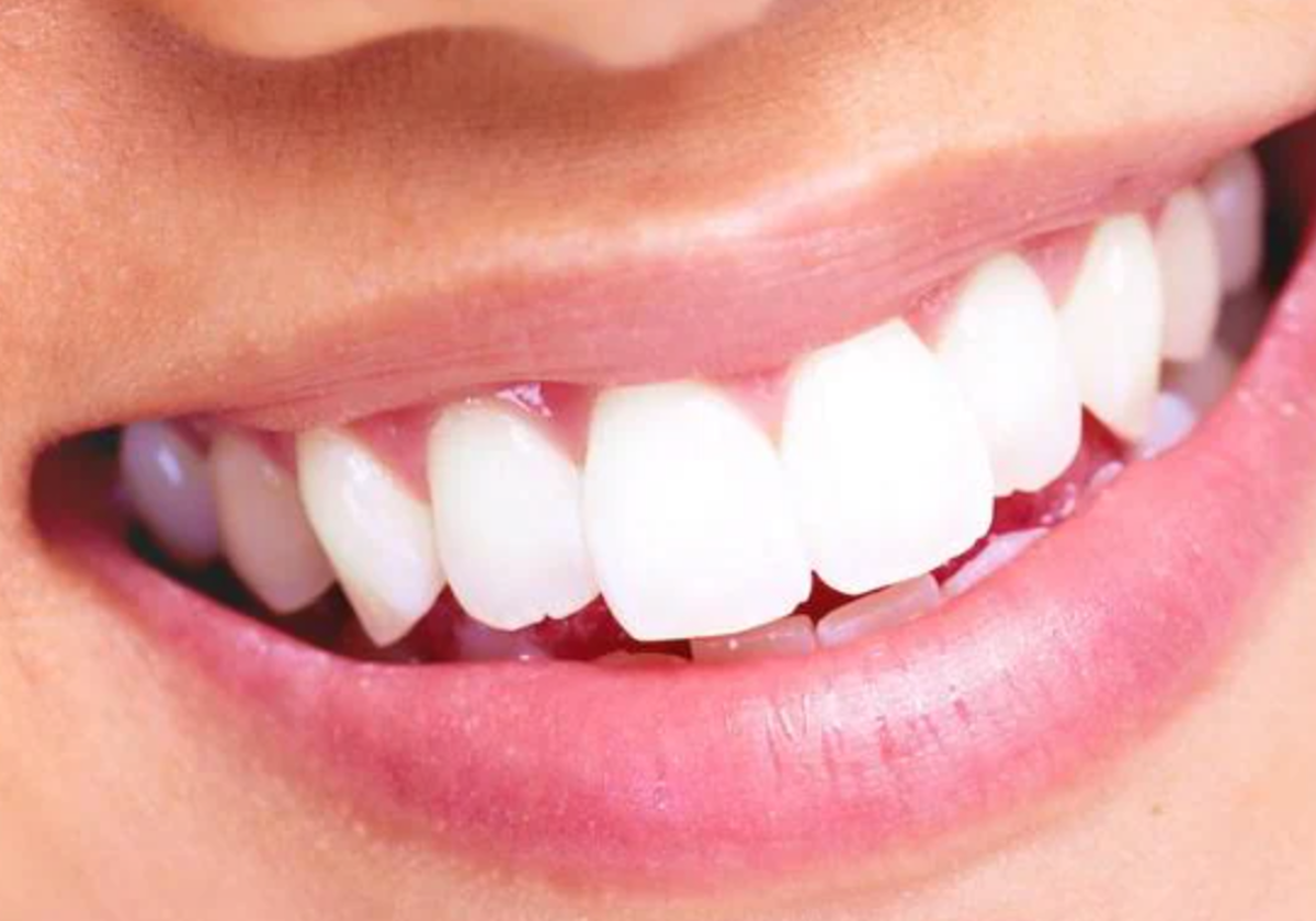 Adiós a los dientes amarillos: el truco infalible para una sonrisa brillante