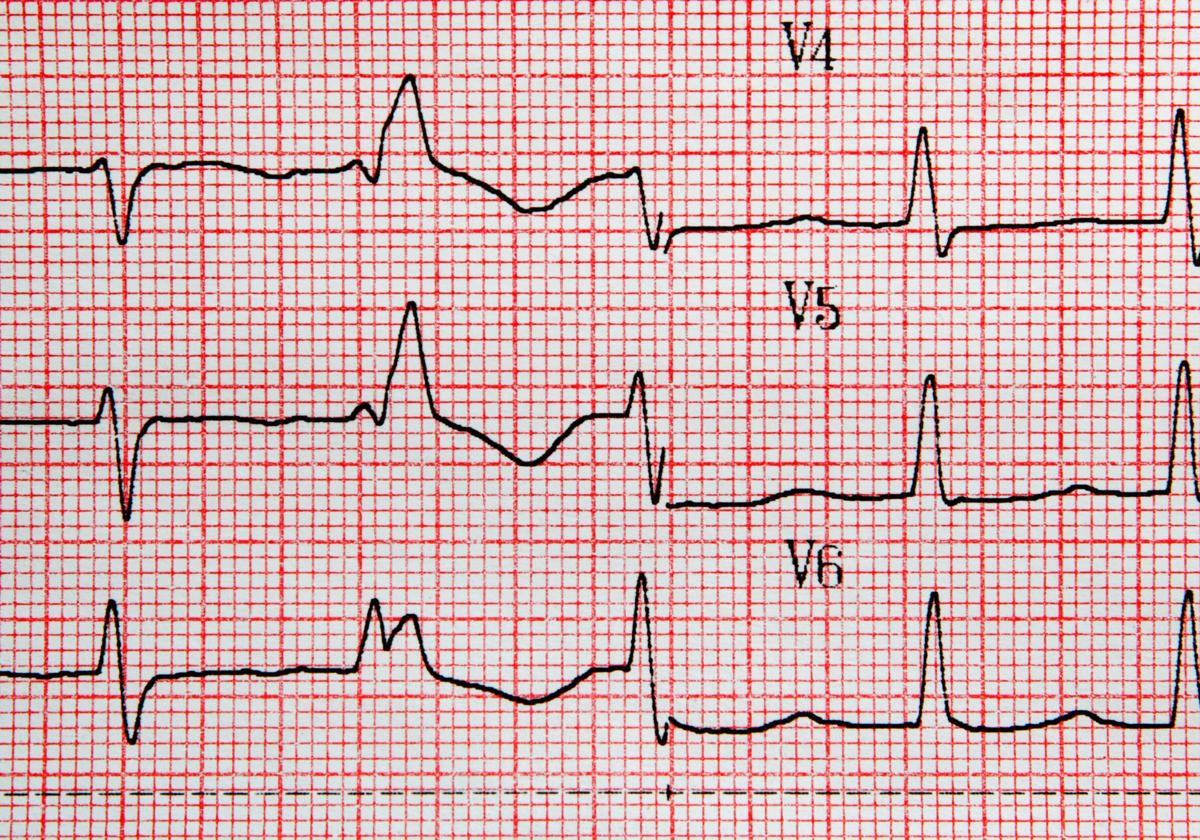 Un electrocardiograma, en una imagen de archivo.