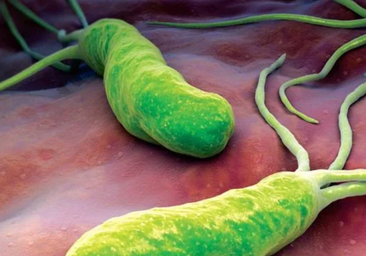 Helicobacter pylori: síntomas, tratamiento y prevención