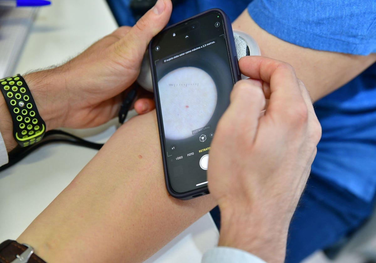 Sanidad usará la IA en dermatología para diagnosticar las lesiones en la piel