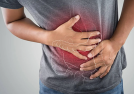 Divertículos en el colon: Qué son, cómo prevenirlos, sus síntomas y opciones de tratamiento