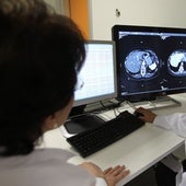 Dos médicos consultan una prueba diagnóstica.