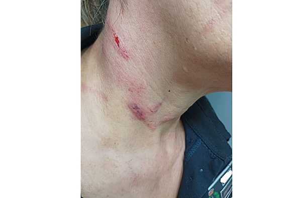 Funcionaria agresida.