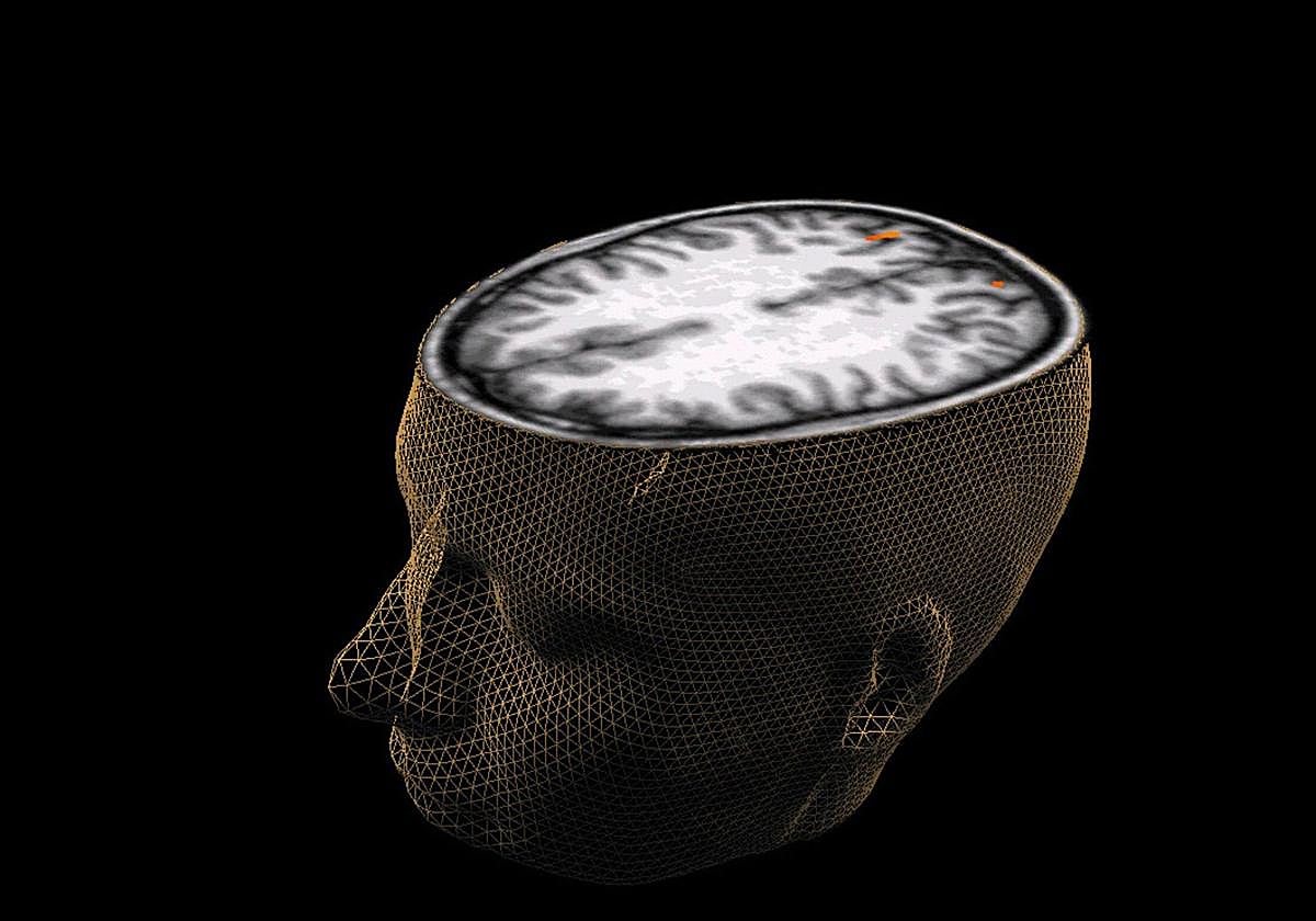 Representación de un cerebro humano.