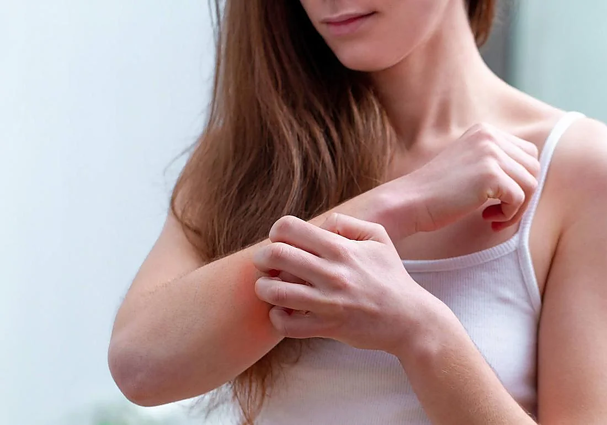 Una mujer se rasca un brazo por una picadura.