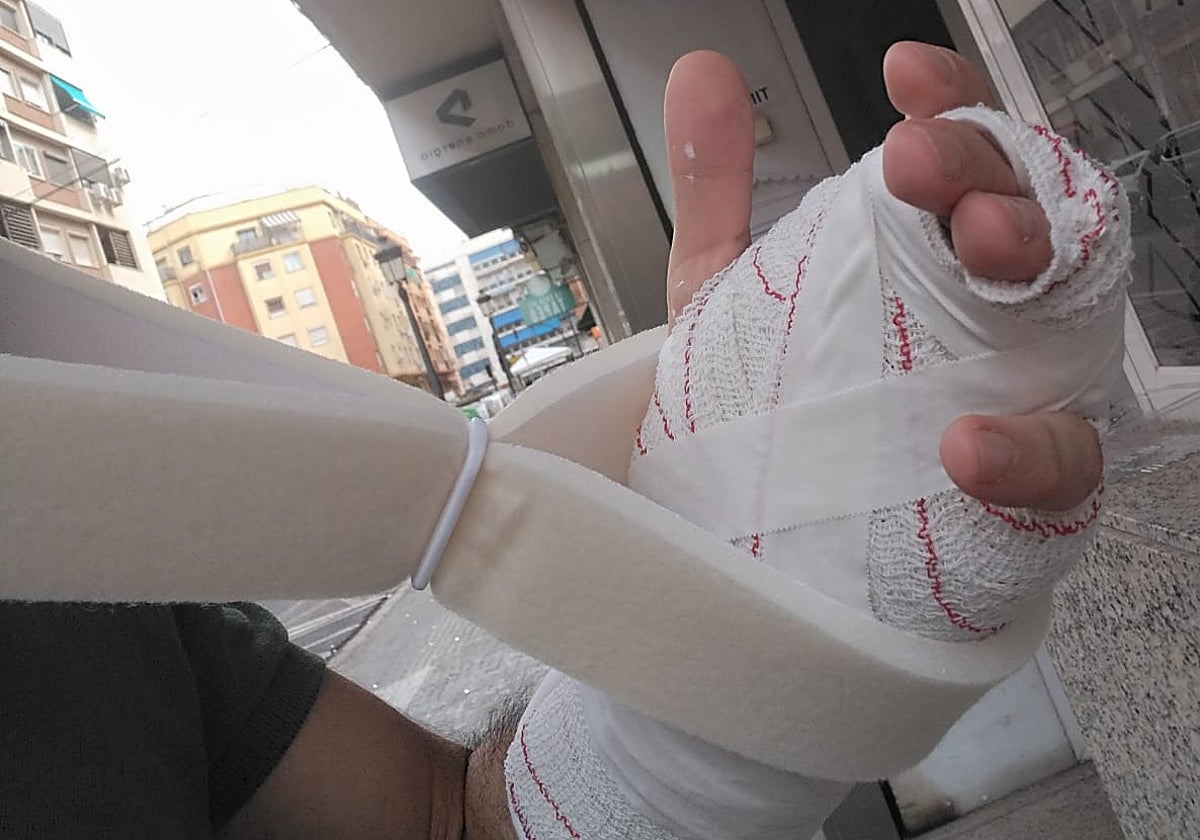 La mano vendada del funcionario agredido.