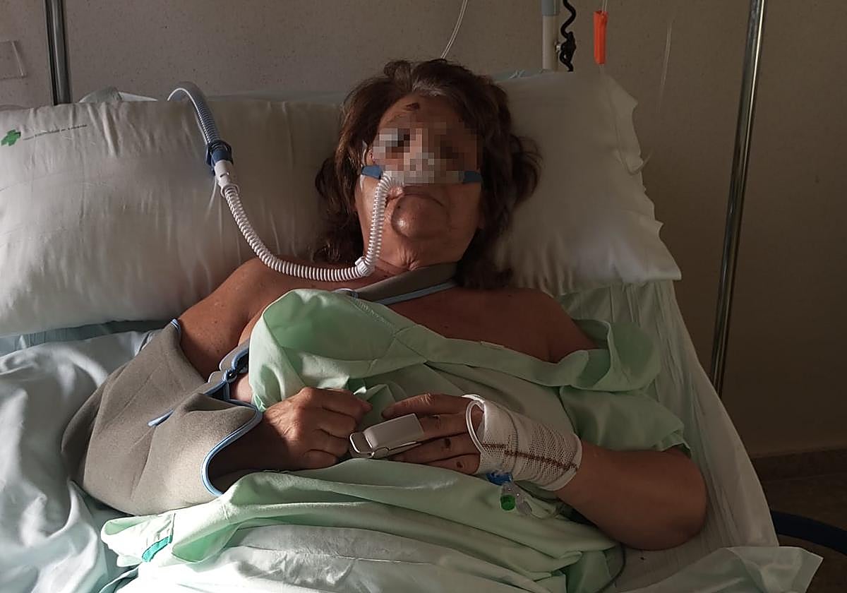 La mujer, en el hospital tras la agresión.