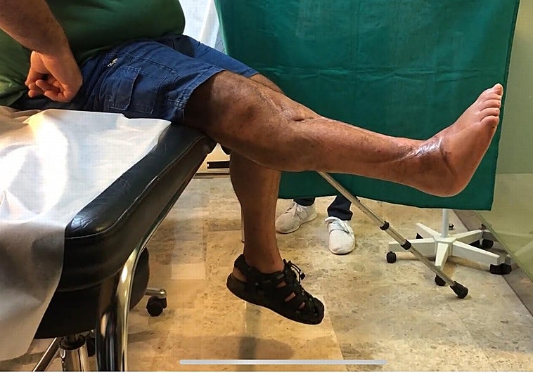 El paciente al que Cavadas ha operado.