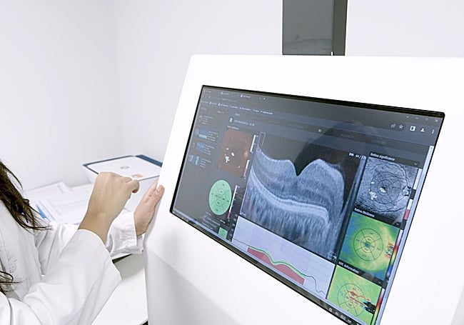 Datos extraídos de la revisión oftalmológica.