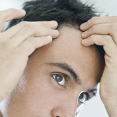 Caída del cabello en una imagen de archivo.